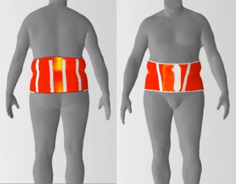 Darstellung des Körperabstandes: Gleichmäßiges Aufliegen der Orthese am Patienten ohne Hohlräume Photo: DITF-MR